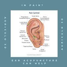 Pin On Ear Acupuncture