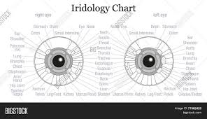 Iris Diagnosis Chart Vector Photo Free Trial Bigstock