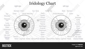 iris diagnosis chart vector photo free trial bigstock