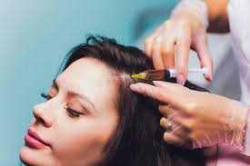 Liệu Pháp Kích Thích Mọc Tóc Bằng Tiêm Mesotherapy – Tinh Tế Beauty