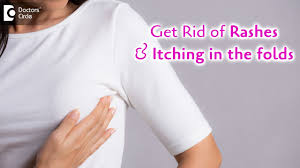 Here is a way how can you give cold compress to the rash between breasts. Rashes Below Breast Fold Remedies To Avoid Itching Under Folds Dr Rajdeep Mysore Doctors Circle Youtube