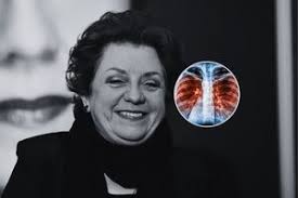 Susan Wojcicki zmarła na raka płuc. Takie objawy może dawać