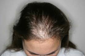 Coupe cheveux très fins et clairsemés. Les Meilleurs Shampoings 2021 Selon Votre Type De Cheveux