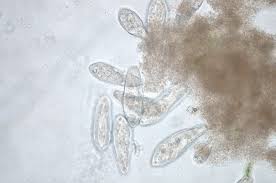 Image result for Protozoa