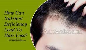 Hair loss can be caused by vitamin deficiency. How Can Nutrient Deficiency Lead To Hair Loss