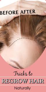 Natural Hair Regrowth Is Possible With These 5 Miraculous Home Remedies In 2020 Natural Hair Regrowth Regrow Hair Naturally Regrow Hair