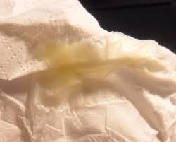 Erstes Mal Tampons Und Jetzt Gelber Ausfluss Gynakologie Med1