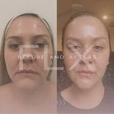 Bare Laser And Skin Clinic