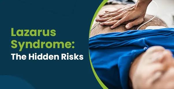 Common Comorbidities of Lazarus Syndrome: Causes & Management