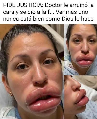 🚨¡TERRIBLE! MUERE NIÑA de 14 AÑOS CIRUGÍA PLÁSTICA: El PADRE NO SABÍA | Mr  Doctor https://youtube.com/live/WjWu1Ku9Exs HOY - 04:00 P.M. - YouTube