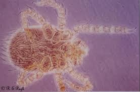 Image result for Trombicula autumnalis