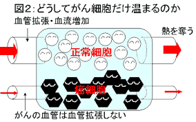 温熱療法 ハイパーサーミア はなぜ がん に効くのでしょうか 日本ハイパーサーミア学会 日本 学会 効く