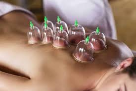 Check out our class schedule www.cuppingtherapy.org and see if we are coming to a city near you! Cupping Therapy Santa Clara Custom Chiropractic