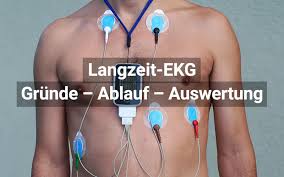 Kardía, deutsch ‚herz', und γράμμα. Langzeit Ekg Praktischarzt