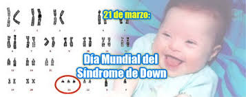 El síndrome de down es una combinación cromosómica natural que siempre ha formado parte de la condición humana, existe en todas las regiones del mundo y habitualmente tiene efectos variables en los estilos de aprendizaje, las. Dibujos De Ninos Con Sindrome De Down Para Colorear Ninos Creativos
