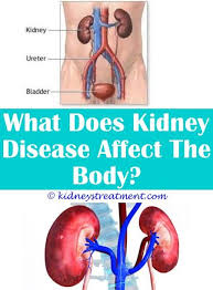 Pin On Kidney Infection Children