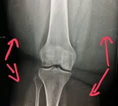 Pin On Unusual X Rays