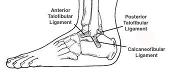 Your sprained ankle usually will swell and hurt following the injury. Ankle Sprain Foot Health Facts