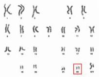 Image result