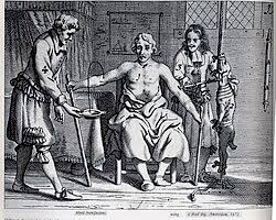 Bloodletting - Wikipedia