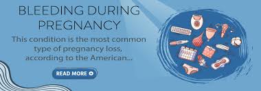 Pictures of spotting during pregnancy 1st trimester. How Heavy Is Breakthrough Bleeding In Pregnancy Healtherely