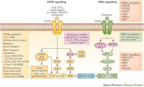 Other symptoms are more obscure, involving organs outside the respiratory system. Non Small Cell Lung Cancer Nature Reviews Disease Primers