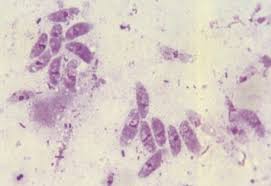 Coccidiose Toxoplasmique Du Chat Et Toxoplasmose Sciencedirect