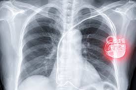 Maybe you would like to learn more about one of these? Dr Martinek Kardiologie
