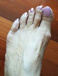 Happy satisfied woman waiting someone in park happy satisfied woman waiting someone in park. Elderly Woman Foot Manicured Wrinkled