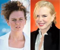 Nicole Kidman Plastic Surgery Before After Cosmetic Surgery Plastic Surgery Types Of Plastic Surgery