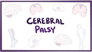 The term cerebral palsy refers to any one of a number of neurological disorders that appear in even though cerebral palsy affects muscle movement, it isn't caused by problems in the muscles or nerves. Cerebral Palsy Cp Causes Symptoms Diagnosis Treatment Pathology Youtube