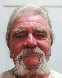 What should Ben do first?