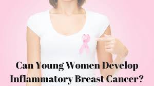 Inflammatory breast cancer is an an aggressive and fast growing breast cancer in which cancer cells infiltrate the skin and lymph vessels of the breast. Can Young Women Develop Inflammatory Breast Cancer Youtube