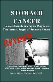 During an endoscopic procedure, your doctor passes a thin, lighted scope through your. Stomach Cancer Causes Symptoms Signs Diagnosis Treatments Stages Of Stomach Cancer Department Of Health And Human Services U S Institutes Of Health National Cancer Institute National Smith S Smith S 9781475035001 Amazon Com Books