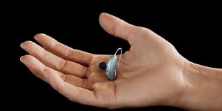 Jedno od važnih pitanja koje se postavlja jeste pitanje cene slušnih aparata. Cena Slusnega Aparata Slusni Aparati Widex Vrhunska Kakovost