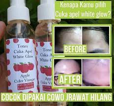 Apr 24, 2020 · untuk membuat toner cuka apel sangatlah praktis, kamu hanya membutuhkan tiga bahan ini, yaitu cuka apel, air mineral, dan botol bersih. Noona Cosmetics Toner Cuka Apel White Glow Kamu Udah Facebook