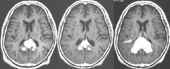 アニメ ラブ アニメの男の子 かわいい アニメのかわいいカップル 赤毛 マンガ 愛してるのおしゃれイメージ画像 プリンセス 赤毛. ä¸­æž¢ç¥žçµŒåŽŸç™ºãƒªãƒ³ãƒ'è…« Pcnsl è„³å¤–ç§'åŒ» æ¾¤æ'è±Šã®ãƒ›ãƒ¼ãƒ ãƒšãƒ¼ã‚¸