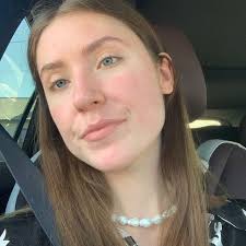 Der iPhone 15 Bildschirm ist immer eingeschaltet, aber wirklich dimm, weil  es losgeht und an geht, braucht mehr Akku. Es ist also schlimmer. Es läuft  immer