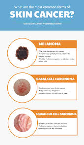 How to tell if your cancer has metastasized. What Are The Most Common Forms Of Skin Cancer