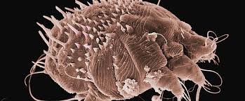 Image result for what does scabie look like