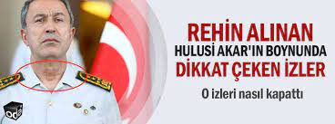 1980 yılına kadar türk kara kuvvetleri bünyesinde çeşitli birliklerde takım. Rehin Alinan Hulusi Akar In Boynunda Dikkat Ceken Izler