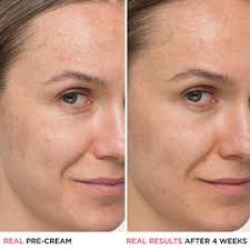 Superhero No-Tug Retractable Liner