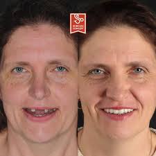 Nasza Dr Sobczak Klinika Gdańsk działa już od roku 🥳🥳🥳 Pacjenci z  Gdańska, którzy byli operowani w Warszawie, mogą teraz przyjeżdżać na  kontrole do naszej Kliniki w Gdańsku. W czasie ostatniego roku,