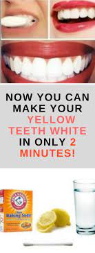 Pin On Diy Teeth Whitening