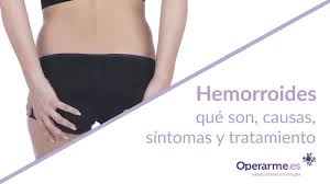 Dolor constante de un día para otro con presencia de una masa o lesión en los márgenes del ano. Trombosis Hemorroidal Externa Que Es Causas Sintomas Y Tratamientos