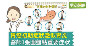 胃癌（stomach cancer、gastric cancer）是发生在胃部黏膜的癌症9。 for faster navigation, this iframe is preloading the wikiwand page for 胃癌. èƒƒç™ŒåˆæœŸç—‡ç‹€èˆ‡èƒƒç‚Žå¾ˆåƒ é†«å¸«1åœ–ç›¤é»žèƒƒç™Œå‰å…†ç—‡ç‹€ æ—©å®‰å¥åº·