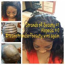 We Beat Alopecia Everytime Get The My Hair Weave Strandsofbeauty Vitamins For Hair Growth Black Women Hair Loss Hair Loss Women