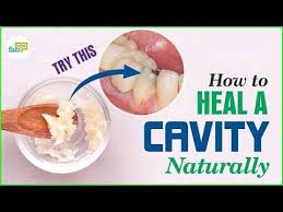Pin On Health