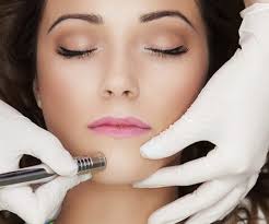 Microdermabrasion treatment in Aurora, Parker and Denver