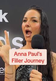 Anna Paul's Journey to Fuller Lips and Lip Filler Tips